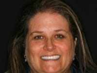 Konig Center for Cosmetic & Comprehensive Dentistry smile photos